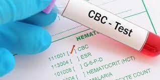 Comprehensive CBC EDTA Blood Test - ManipalTRUtest