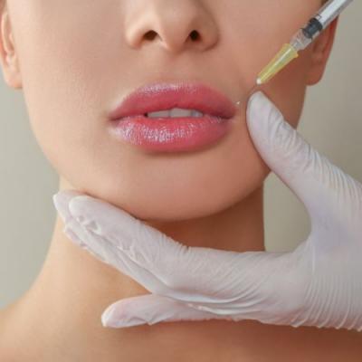 Lip Fillers-Injections Eugene - Other Other