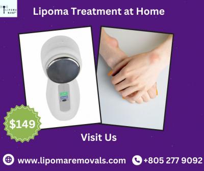 Discover Lipoma Treatment Without Surgery With Lipoma Wand - New York Other