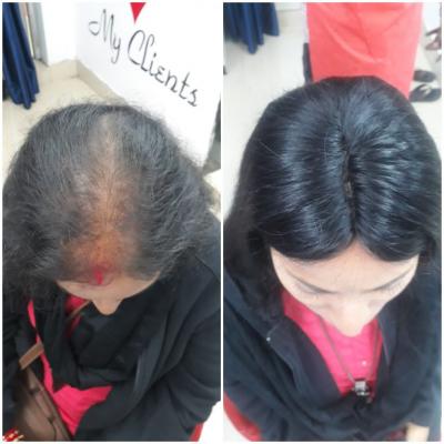 Best Female Permanent Hair Extensions in Bhubaneswar