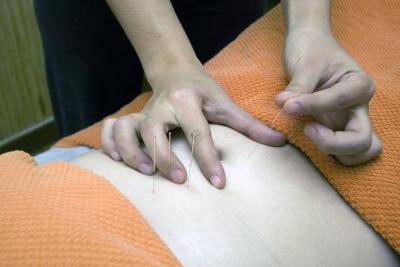 Harmony and Health: Chinese Acupuncture at OTCM, Milton, ON