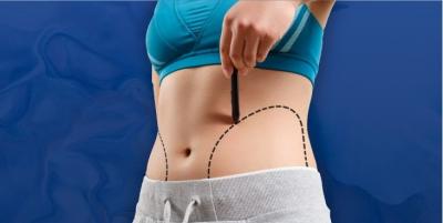 Coolsculpting | Fat Freezing | Belly & Body Fat Removal | Tone Muscle