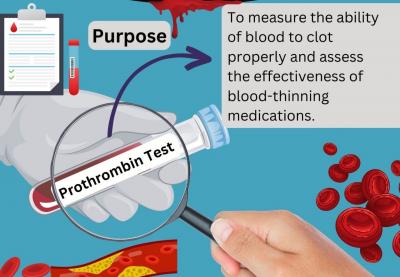 Prothrombin Time, Plasma Test at Agilus Diagnostics 