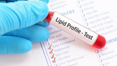 Lipid Profile Test at Home - Manipal TRUtest