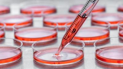 Exploring the Three Types of Cell Culture Available at Denovo Technologies