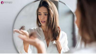 Hair Fall Doctor in Noida