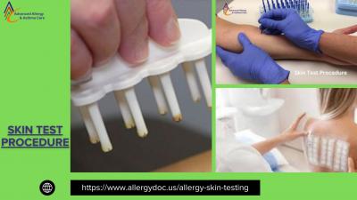 Don’t miss out on most authentic skin test procedure in the US