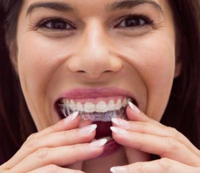 Superior Invisalign Solutions in Ahmedabad