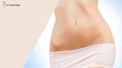 Abdominoplasty in Dubai - Dr. Parag Telang