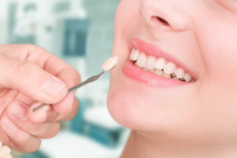 Merrylands Smiles: Krown Dental - Your Gateway to Healthy Teeth! - Sydney Health, Personal Trainer