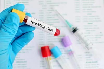 Discover Our Comprehensive Food Allergy Profile: Get Tested Today!