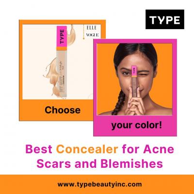 Best Concealer for Acne Scars and Blemishes - Delhi Other