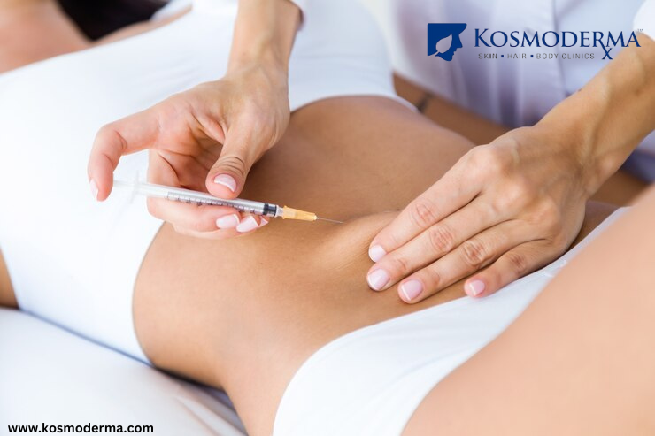 Expert Liposuction: Body Fat Removal Delhi by Kosmoderma - Delhi Health, Personal Trainer