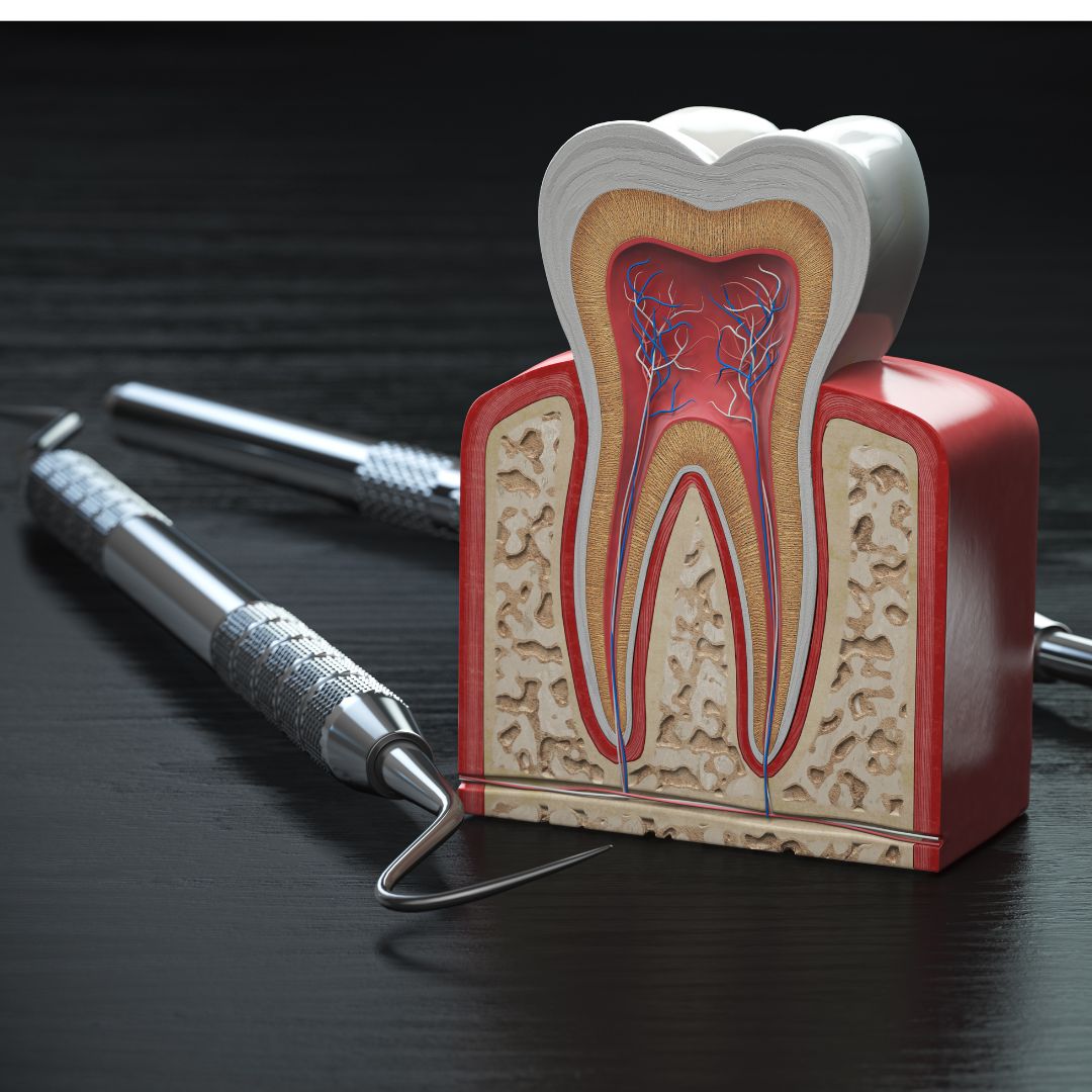 Premier Root Canal Treatment in Kolkata at Mission Smile Dental Centre