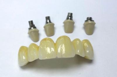 Find the Best Quality of Zirconia Crown in China