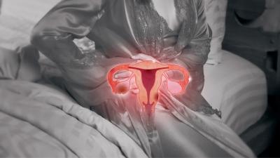 Uterine Anomalies in Infertility - Audubon Fertility Expert Insights