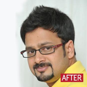 Hair Fixing in Trichy - Tiruchirappalli Other