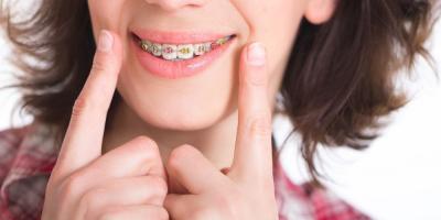 Choose Affordable Braces for Adults in NJ | Freehold Orthodontics LLC