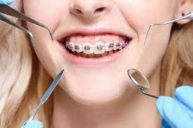 Expert Orthodontics Services in Richmond, TX