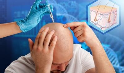 Achieve the Best Hair Transplant in the UK with Want Hair! - London Health, Personal Trainer