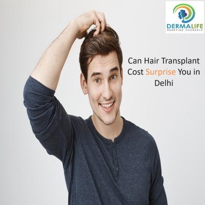 Can Hair Transplant Cost Surprise You in Delhi? - Delhi Health, Personal Trainer