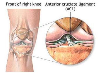 Knee ACL Ligament Surgery In Dubai - Jaipur Other