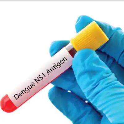 Agilus Diagnostics offers Dengue NS1 Antigen Test