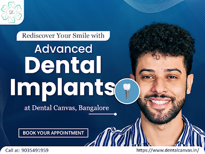 Dental Implants in Bangalore | Affordable Implant Solutions | Dental Canvas®