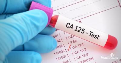 A Trustworthy CA 125 Test for Detecting Ovarian Cancer at Agilus Diagnostics - Delhi Health, Personal Trainer