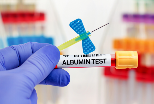 Explore Your Wellness - Albumin Blood Test at Agilus Diagnostics