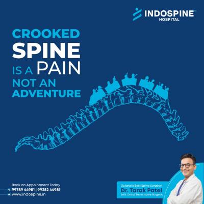Spinal Cord Specialist in Ahmedabad