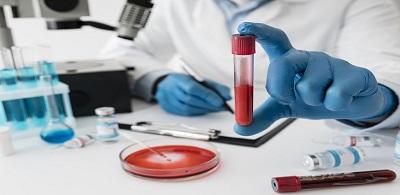 Book CBR & CRP Blood Tests at Max Lab | Home Sample Collection Available