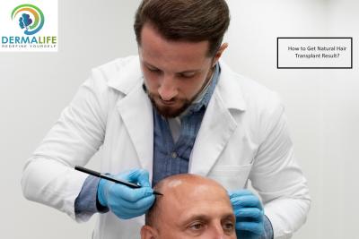 How to Get Natural Hair Transplant Result? - Delhi Health, Personal Trainer