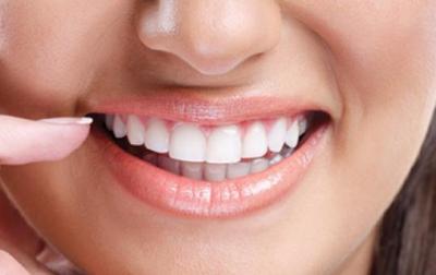 Smile Makeover Treatment Ahmedabad | 9825158578 - Ahmedabad Health, Personal Trainer