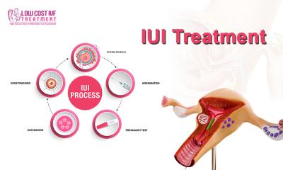 Affordable IUI Treatment in Bangalore - Low Cost IVF Treatment 