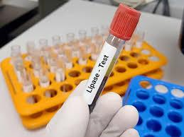 Lipase Test Services in Pune