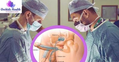Best penile implant surgery in India - Orchidz Health - Bangalore Health, Personal Trainer