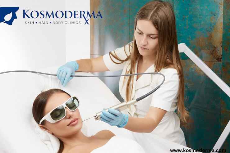 Premier Laser Treatments for Acne Scars at Kosmoderma in Delhi