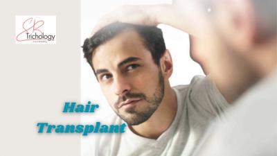 Hair Transplant In Gurgaon - Bangalore Health, Personal Trainer