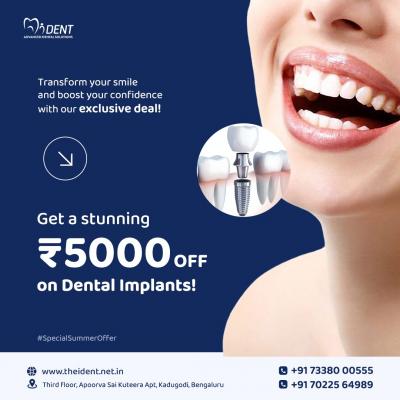 Revitalize Your Smile: Seegehalli's Top Dental Implant Services - Bangalore Health, Personal Trainer