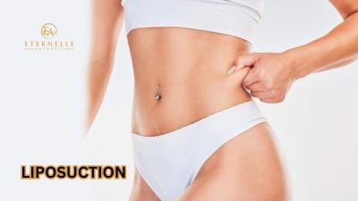 Liposuction In Hyderabad | Eternelle Aesthetics