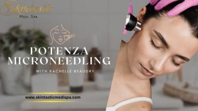 Luxurious Potenza Microneedling Near Me - Sacramento Other