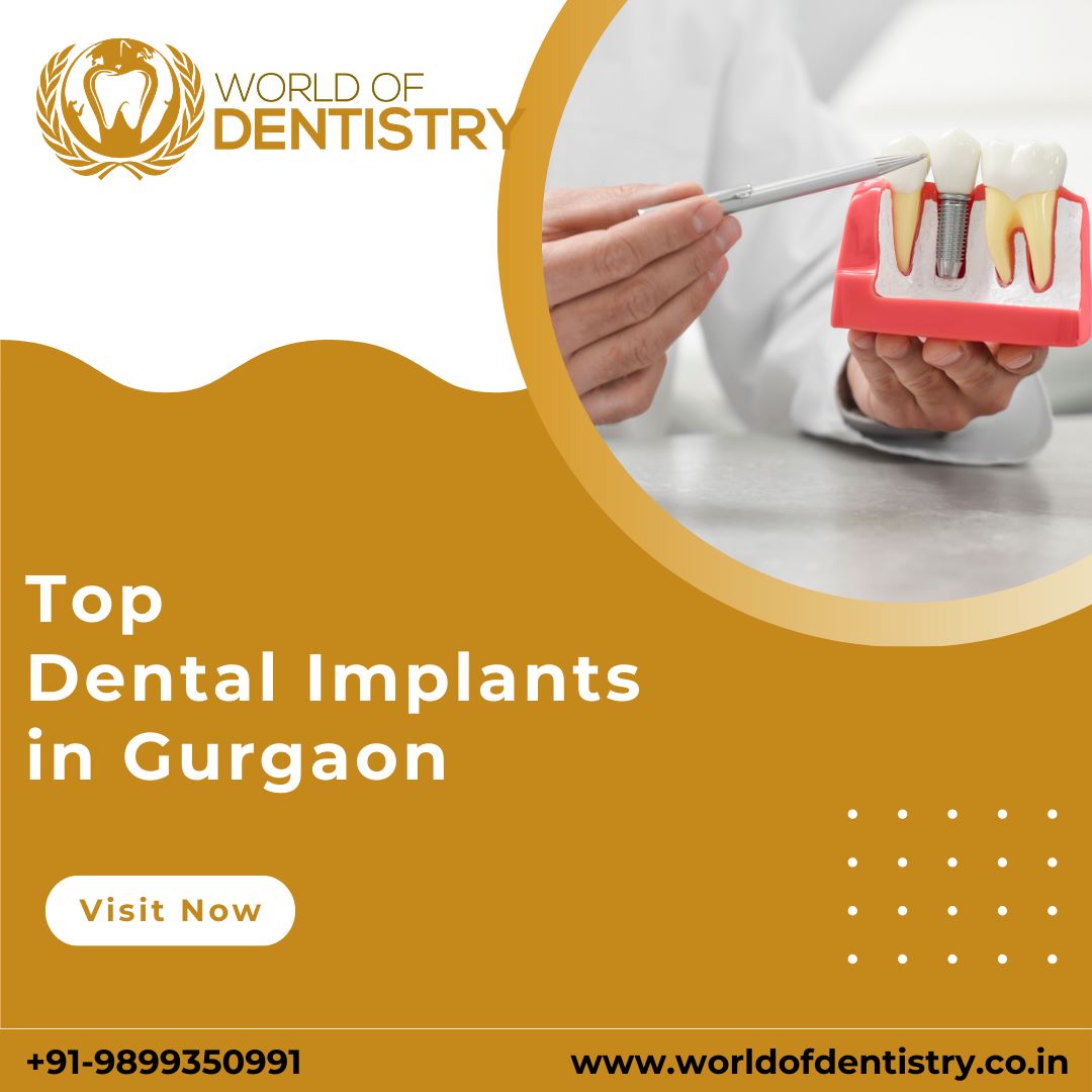 Get the Best Dental Implants in Gurgaon