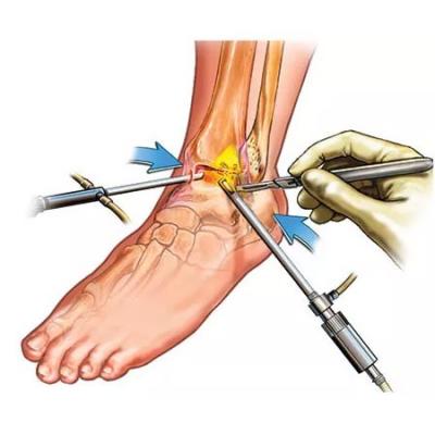 Joint Replacement Surgeon - Ahmedabad Other