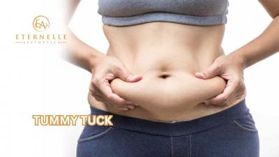 Tummy Tuck In Hyderabad - Hyderabad Health, Personal Trainer