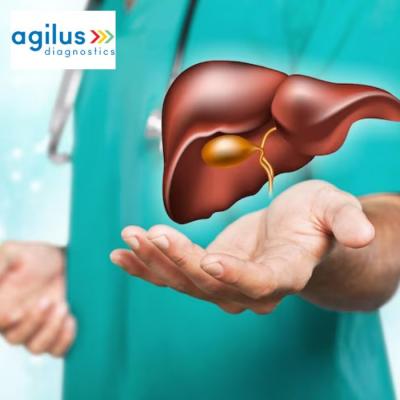 Comprehensive Liver Test with Agilus Diagnostics App