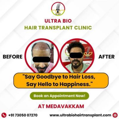 hair treatment in chennai - Chennai Health, Personal Trainer