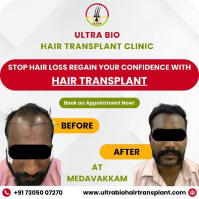 hair treatment in chennai - Chennai Health, Personal Trainer