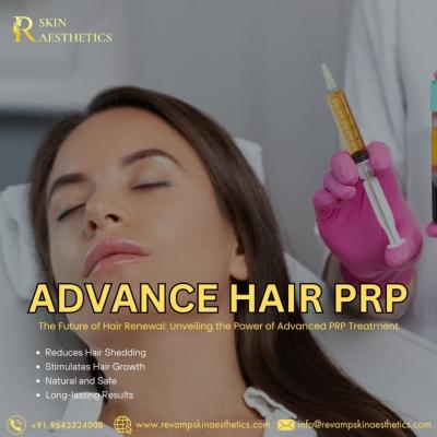 Advanced Prp Treatment for Hair Restoration - Delhi Health, Personal Trainer