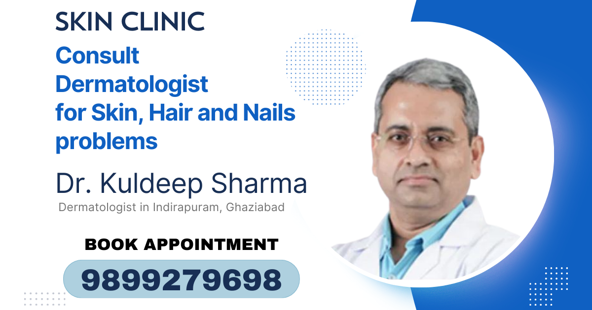 Best Dermatologist (Skin Doctor) in Indirapuram, Ghaziabad 